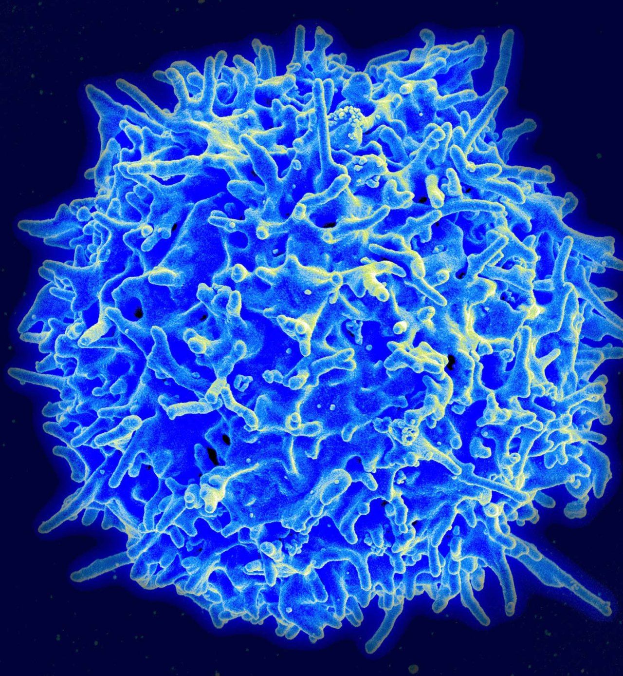 Hum T-Cells-NIH